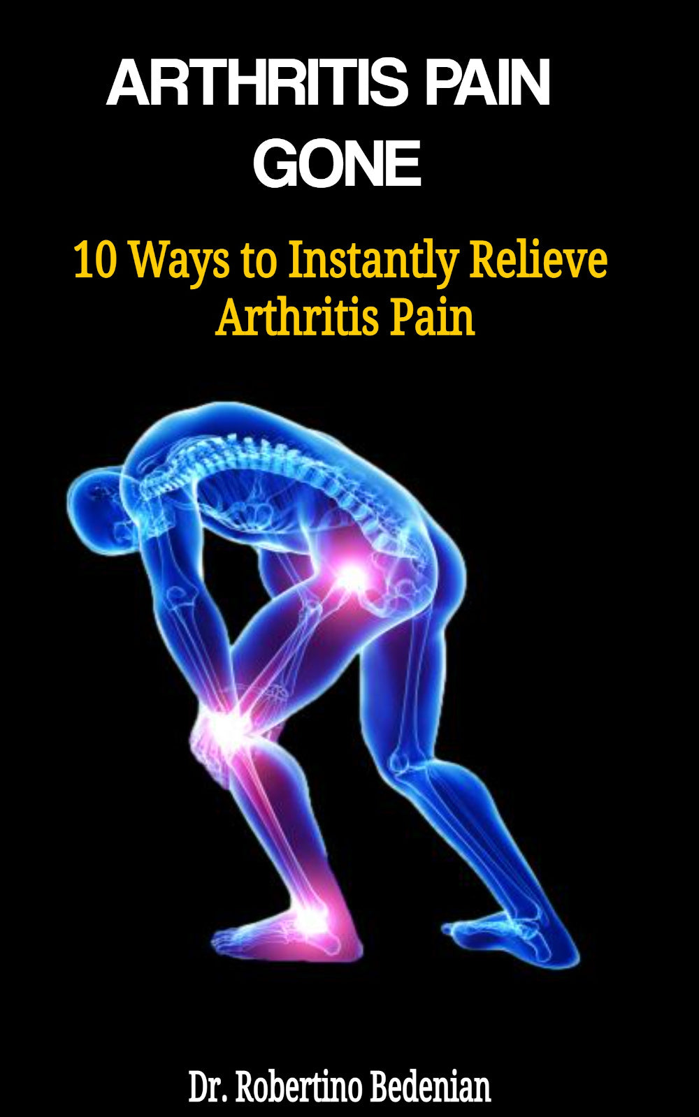 Arthritis Pain Gone - 10 Ways to Instantly Relieve Arthritis Pain (Ebook)